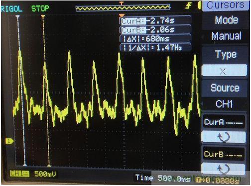 可穿戴技術(shù)在醫(yī)學(xué)領(lǐng)域遍地生花:脈搏血氧計(jì)問世