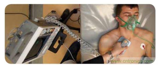 帶電極的醫(yī)院用除顫器。注意，患者身上有外部心電圖或心臟監(jiān)護(hù)儀，從胸部的白色圓片(電極)和導(dǎo)聯(lián)(線)可看出來。