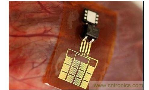 可將人體變成電腦的電子皮膚！