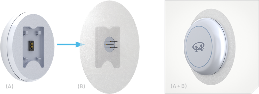 如何使用動(dòng)態(tài)血糖監(jiān)測設(shè)備(CGM)管理糖尿病 如何使用動(dòng)態(tài)血糖監(jiān)測設(shè)備(CGM)管理糖尿病